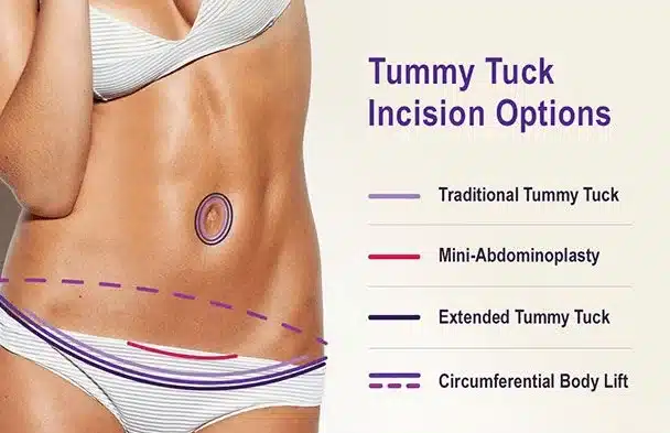 What you need to know about your tummy tuck recovery, by Turkeynosejob Com