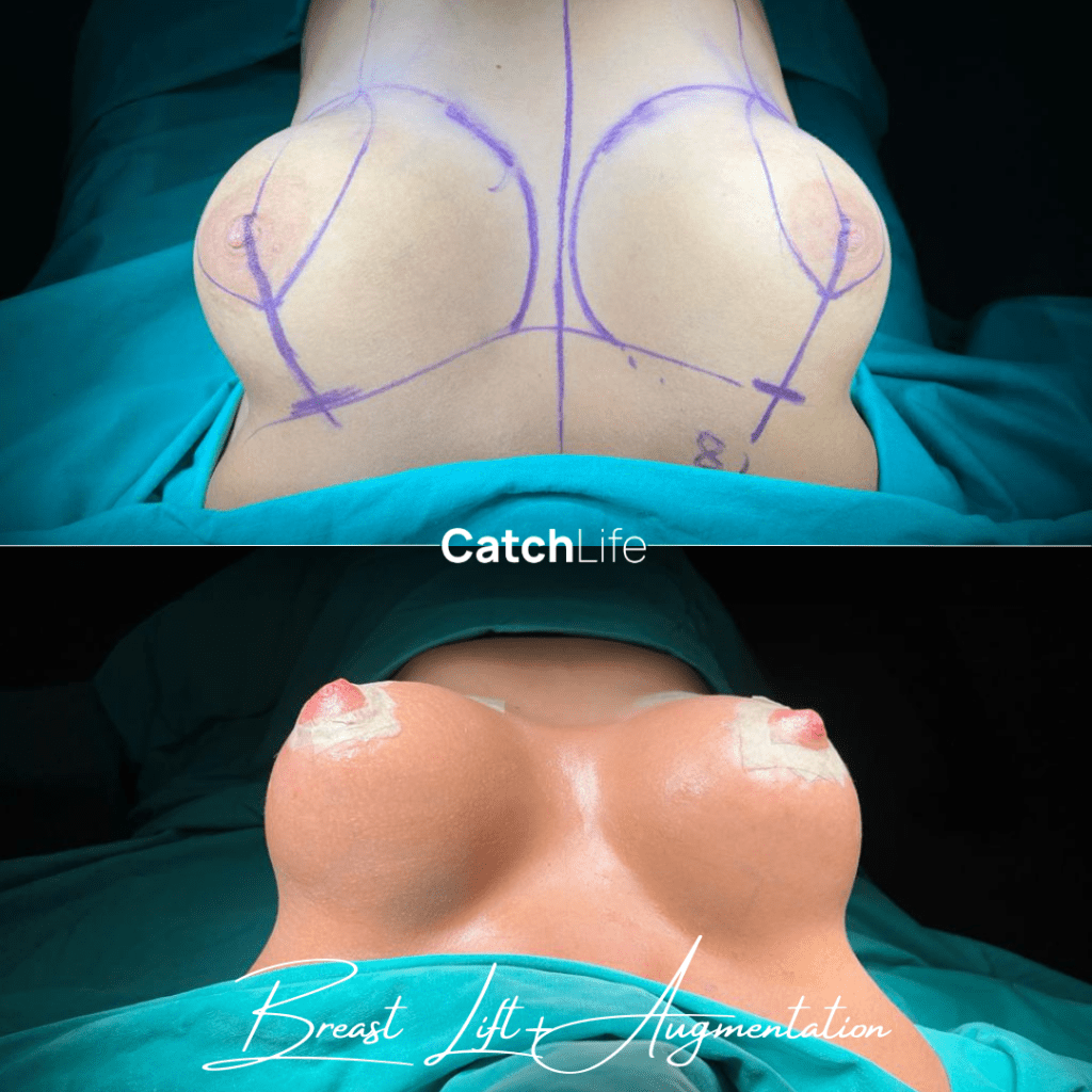 Post CatchLife B-A Şablon