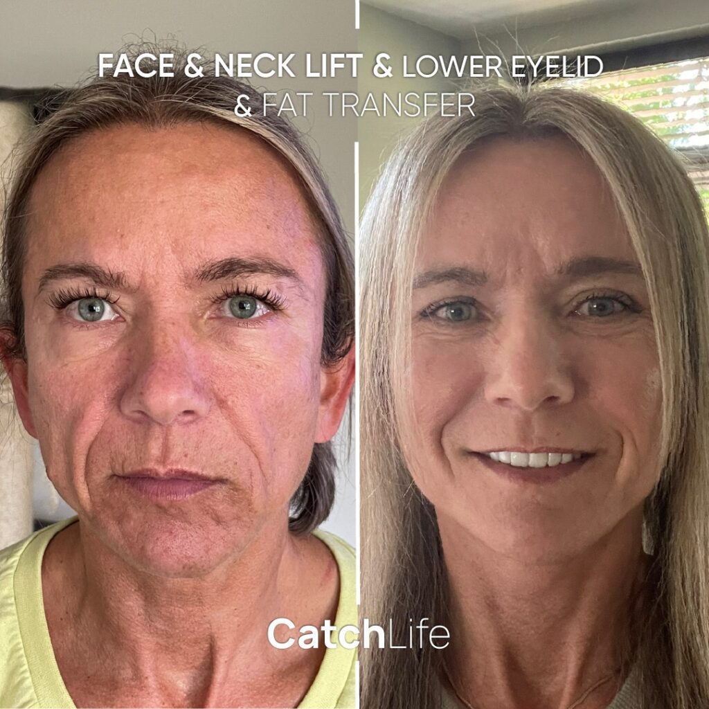 WhatsApp Image 2023-05-27 at 14.09.06