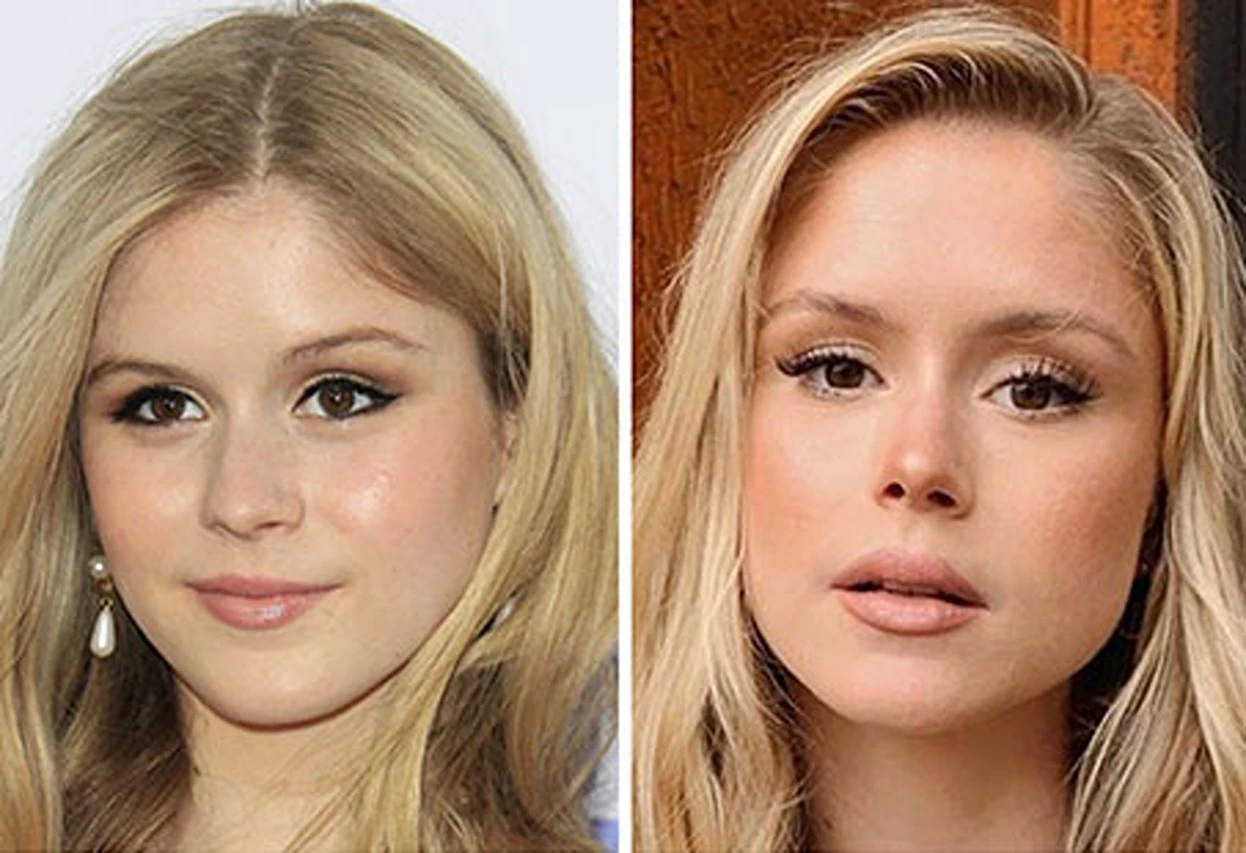 Erin Moriarty Plastic Surgery Before and After Journey - CatchLife ...