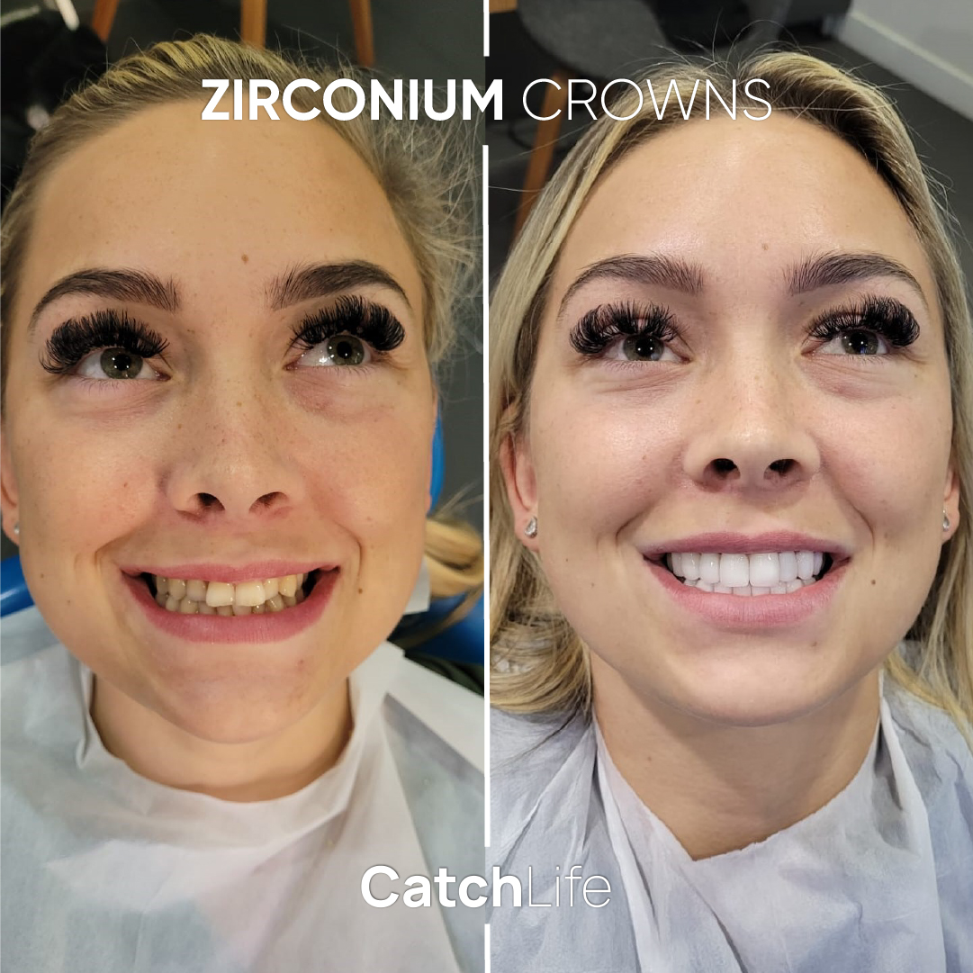 zirconium-100